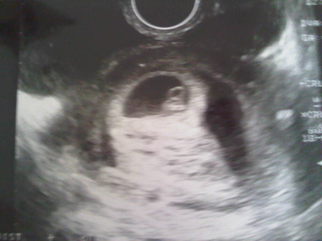 IMG-20120927-02647 - 