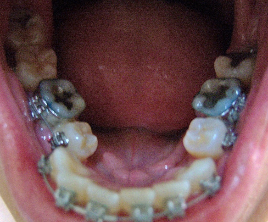 Lower row (2nd adjustment) test - 