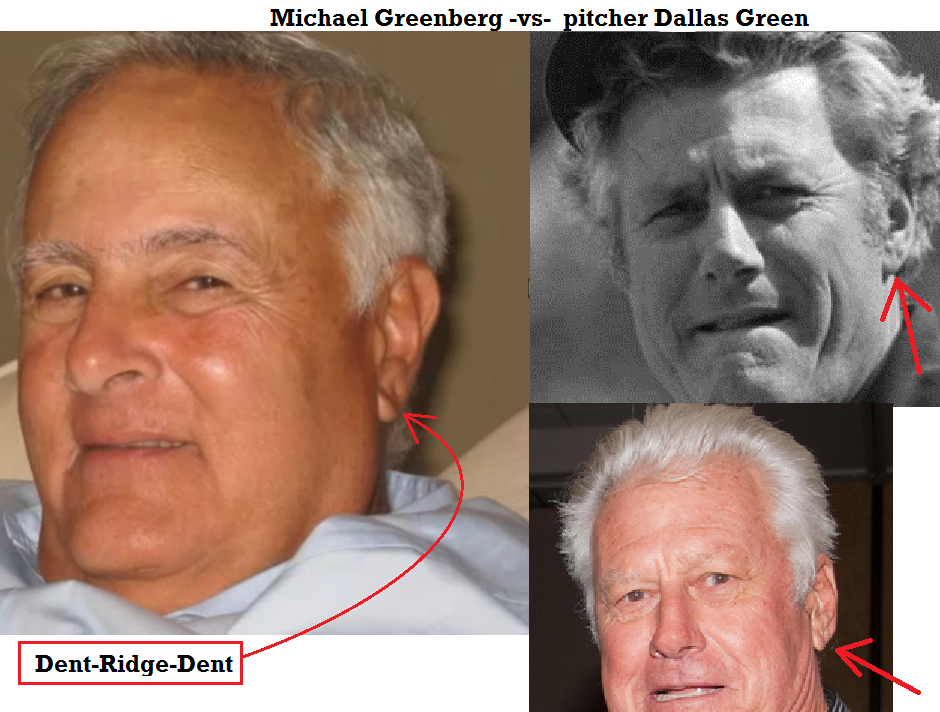 Michael Greenberg -vs- Dallas Green the pitcher - 