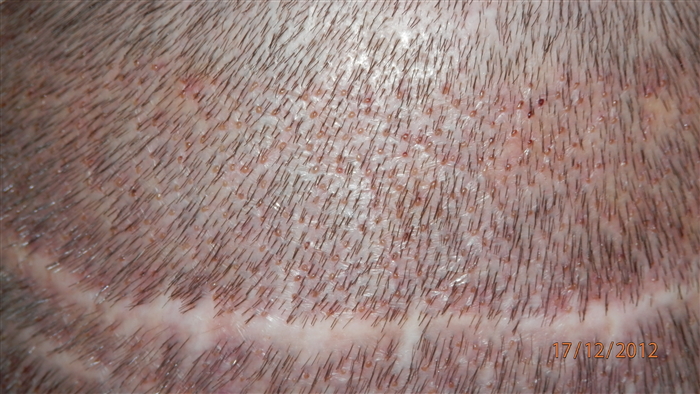 2879 image1248 (1) - 