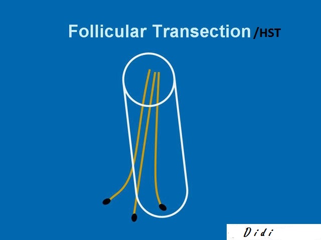 fue3f challenges lg - 