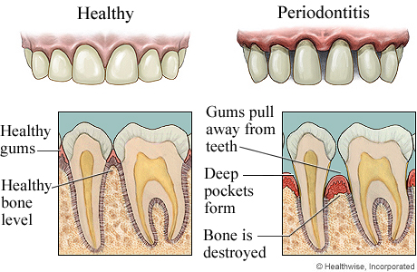 dentist Oral Health