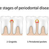 shutterstock 157672241 reduced - Oral Health