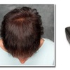John Vincent Hair Restorati... - Picture Box