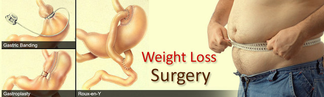 dr-pradeep-jain-weight-loss-surgery1 Dr Pradeep Jain