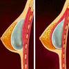 Breast Implant Surgeons in ... - Breast Augmentation Las Veg...
