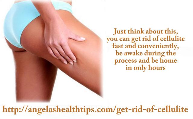 Most Women Would Love To Get Rid Of Cellulite Picture Box