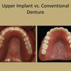 upper dental1 - Picture Box