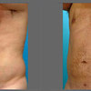 www.chicagolipo - Chicago Lipo Center