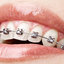 Orthodontist - blenkitts