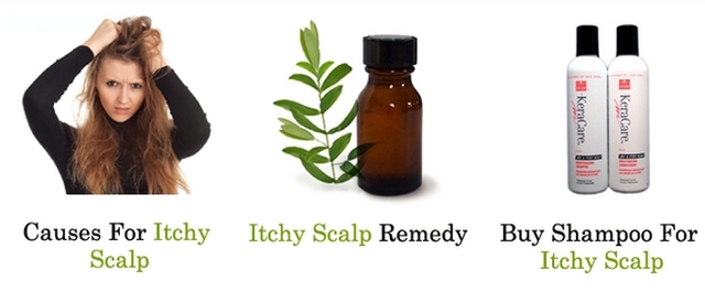 Causes For Itchy Scalp Picture Box