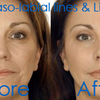Anti Wrinkle Injections Syd... - Star Cosmetic Medicine