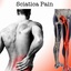 mesotherapy, sciatica pain ... - Picture Box