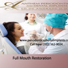 Periodontist Las Vegas - Periodontist Las Vegas