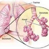 The-cancer-of-the-mesotheli... - read news