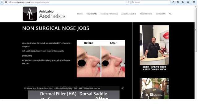 non surgical nosejob nose job