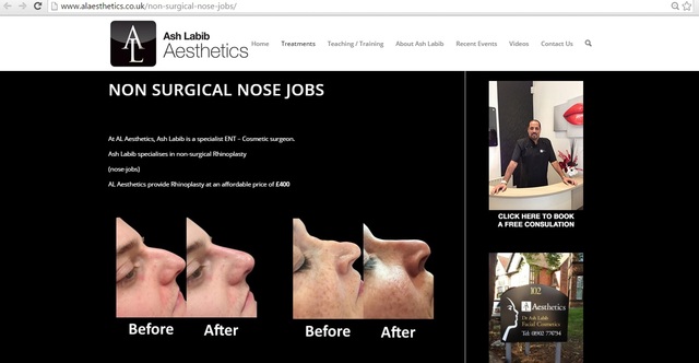 Non Surgical Rhinoplasty UK Non Surgical Nosejobs UK