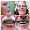 dentures peterborough - Apple Denture and Implant S...