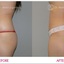 plastic surgery toronto - Toronto Cosmetic Surgery Institute