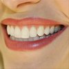 Beljenje zob od Artident - Artident