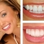 Dental Implants North Carolina - Dental Implant Charlotte