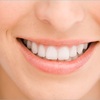 dental implants wellington - City Dentists Ltd