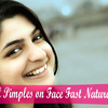 Get-Rid-of-Pimples-on-Face-... - How To Get Rid Of Pimples
