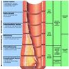 image atherosclerosis endot... - Picture Box