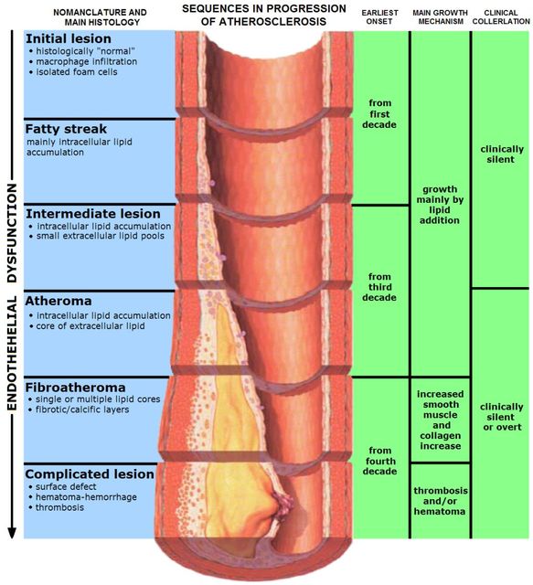 image atherosclerosis endothelial dysfunction Picture Box