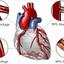 High Triglycerides - Picture Box