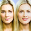 beauty-basics-before-after-... - Picture Box