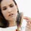 sdscd - Natural Treatments for Hair Loss
