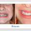 find a dentist henderson - Picture Box