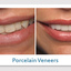 dental implants 89129 - Picture Box