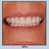 Tucson AZ Dental Implants P... - Dr Jay Citrin DDS