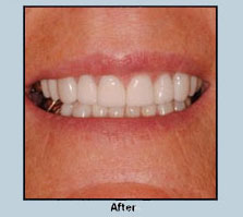Tucson AZ Dental Implants Periodontis  (520) 887-8 Dr Jay Citrin DDS