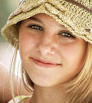 GIRL-STRAW-HAT Applying Fresh Garlic To Struggle Acne