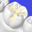 fillings1-150x150@2x - Freedom Family Dentistry