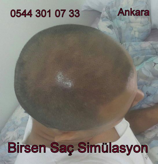 profesyonel saç simülasyon Birsen Saç Simülasyonu Ankara