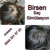 profesyonel saç simülasyon - Ankara Saç Simülasyonu