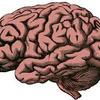 The brain on a constant sup... - Picture Box