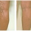 spider veins specialist val... - Varicose Veins Valencia | 661-799-7459