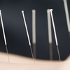 acupuncture pic1 - Myungmun