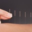 Acupuncture-slider - Myungmun