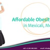 Obesity Surgery in Mexicali... - Picture Box