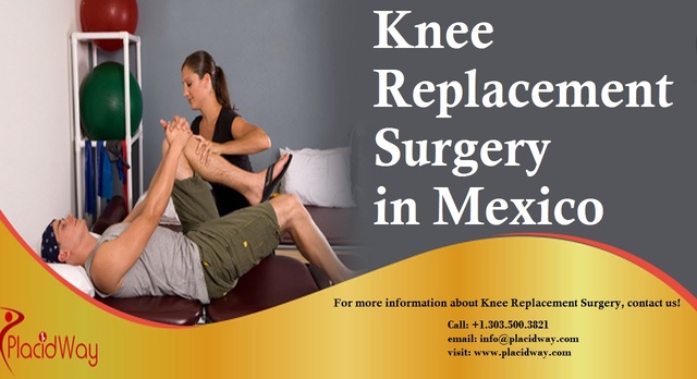 Knee Replacement Surgery in Mexico Health and Wellness