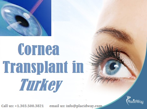 Cornea Transplant in Turkey Health and Wellness
