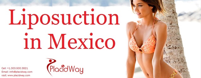Liposuction Mexico Health and Wellness