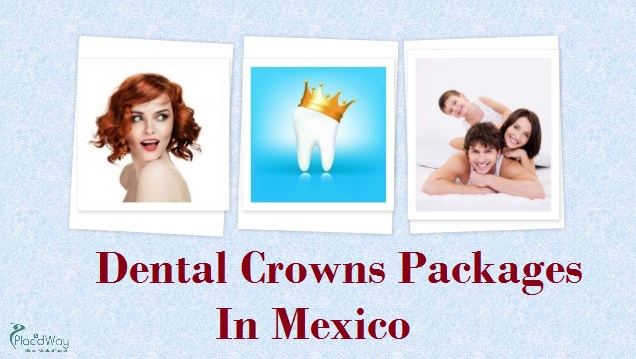 Dental Crowns Packages in Mexico Wellness Tourism