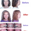 orthodontist in indianapoli... - Picture Box